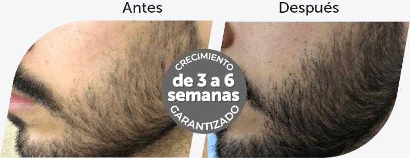 Crecimiento de cejas y barba para hombres